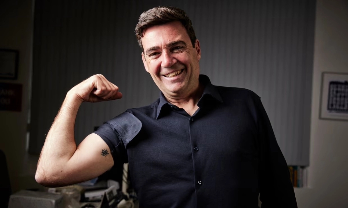 Burnham showing off his bee tattoo